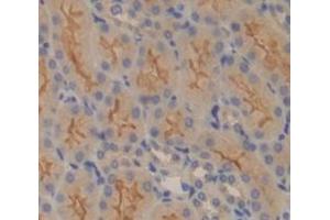 Immunohistochemistry (IHC) image for anti-Solute Carrier Family 30 (Zinc Transporter), Member 6 (SLC30A6) (AA 253-458) antibody (ABIN1870957)