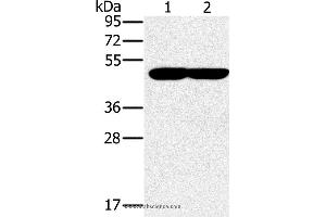 Western blot analysis of K562 and 293T cell, using PPOX Polyclonal Antibody at dilution of 1:200 (PPOX antibody)