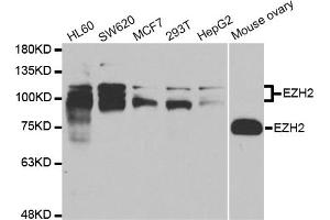 Western blot analysis of extracts of various cell lines, using EZH2 antibody. (EZH2 antibody)