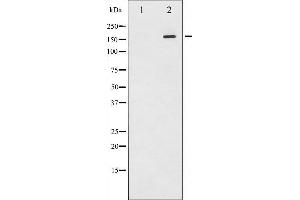 Western blot analysis of EGFR phosphorylation expression in EGF treated A431 whole cell lysates,The lane on the left is treated with the antigen-specific peptide. (EGFR antibody  (pTyr1110))