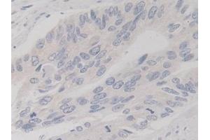 Immunohistochemistry (IHC) image for anti-TANK-Binding Kinase 1 (TBK1) (AA 9-310) antibody (ABIN7441433)