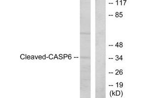 Western blot analysis of extracts from HeLa cells, treated with etoposide (25 μM, 1hour), using Caspase 6 (cleaved-Asp162) antibody. (Caspase 6 antibody  (Cleaved-Asp162))