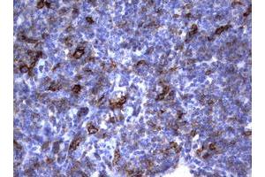 Image no. 3 for anti-Fc Fragment of IgE, Low Affinity II, Receptor For (CD23) (FCER2) (AA 48-321) antibody (ABIN1491554) (FCER2 antibody  (AA 48-321))