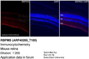 Image no. 2 for anti-RNA Binding Protein with Multiple Splicing (RBPMS) (N-Term) antibody (ABIN2778710) (RBPMS antibody  (N-Term))