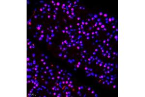 Immunofluorescence of paraffin embedded rat pancreas using ALS2CR13 (ABIN7073909) at dilution of 1:650 (400x lens) (FAM117B antibody)