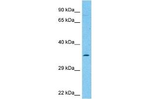 Host:  Rabbit  Target Name:  NCEH1  Sample Type:  THP-1 Whole Cell lysates  Antibody Dilution:  1. (NCEH1 antibody  (C-Term))