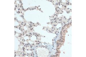 Immunohistochemistry of paraffin-embedded Mouse lung using Thioredoxin 1 (Trx1/Thioredoxin 1 (Trx1/TXN)) antibody (ABIN7270798) at dilution of 1:100 (40x lens). (TXN antibody  (C-Term))