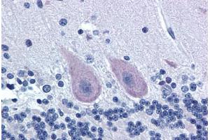 Human Brain, Cerebellum (formalin-fixed, paraffin-embedded) stained with GRM1 antibody ABIN239868 at 20 ug/ml followed by biotinylated goat anti-rabbit IgG secondary antibody ABIN481713, alkaline phosphatase-streptavidin and chromogen. (Metabotropic Glutamate Receptor 1 antibody  (C-Term))
