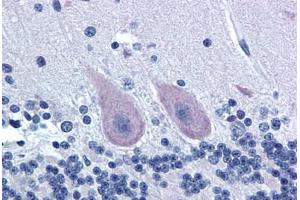 Human Brain, Cerebellum (formalin-fixed, paraffin-embedded) stained with GRM1 antibody ABIN239868 at 20 ug/ml followed by biotinylated goat anti-rabbit IgG secondary antibody ABIN481713, alkaline phosphatase-streptavidin and chromogen. (Metabotropic Glutamate Receptor 1 antibody  (C-Term))