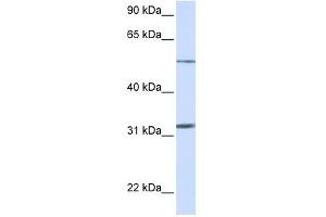 SLC35A5 antibody used at 1 ug/ml to detect target protein. (SLC35A5 antibody  (N-Term))