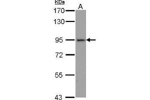 WB Image Sample (30 ug of whole cell lysate) A: HepG2 7. (ACE2 antibody  (N-Term))