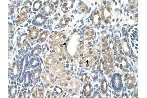 PBEF1 antibody was used for immunohistochemistry at a concentration of 4-8 ug/ml to stain Epithelial cells of renal tubule (arrows) in Human Kidney. (NAMPT antibody  (C-Term))