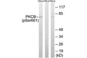 Western blot analysis of extracts from HeLa cells treated with heat shock, using PKCB (Phospho-Ser661) Antibody. (PKC beta antibody  (pSer661))