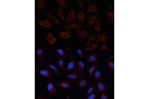 Immunofluorescence analysis of U2OS cells using  antibody (ABIN6129706, ABIN6136901, ABIN6136902 and ABIN6214776) at dilution of 1:100.