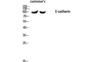 Western Blot (WB) analysis of using E-cadherin Polyclonal Antibody. (E-cadherin antibody  (N-Term))