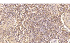 Detection of PF4 in Human Spleen Tissue using Monoclonal Antibody to Platelet Factor 4 (PF4) (PF4 antibody  (AA 31-101))