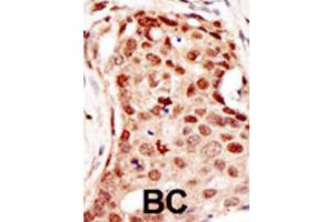 Immunohistochemistry (IHC) image for anti-Cbl proto-oncogene C (CBLC) antibody (ABIN2996838) (CBLC antibody)