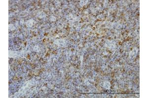 Immunostaining (ISt) image for anti-Major Histocompatibility Complex, Class II, DP beta 1 (HLA-DPB1) (AA 1-258) antibody (ABIN561271)