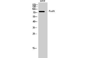 Western Blotting (WB) image for anti-Forkhead Box O1 (FOXO1) (Ser256) antibody (ABIN5956567) (FOXO1 antibody  (Ser256))