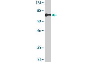 Western Blot detection against Immunogen (75. (CDR2 antibody  (AA 1-454))