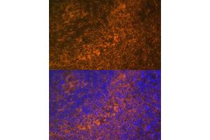 Immunofluorescence analysis of rat spleen using TNFRSF10A Polyclonal Antibody (ABIN6127583, ABIN6149301, ABIN6149303 and ABIN6216204) at dilution of 1:100 (40x lens). (TNFRSF10A antibody  (AA 269-468))