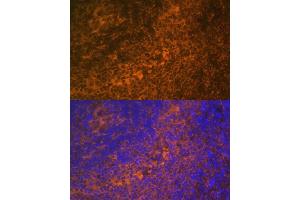 Immunofluorescence analysis of rat spleen using TNFRSF10A Polyclonal Antibody (ABIN6127583, ABIN6149301, ABIN6149303 and ABIN6216204) at dilution of 1:100 (40x lens).