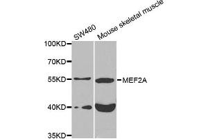Western blot analysis of extracts of various cell lines, using MEF2A antibody. (MEF2A antibody)