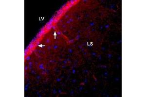 Expression of NBCe1 in rat lateral septum - Immunohistochemical staining of immersion-fixed, free floating rat brain frozen sections using Anti-SLC4A4 (NBC1) (extracellular) Antibody (ABIN7043728, ABIN7044817 and ABIN7044818), (1:400). (SLC4A4 antibody  (2nd Extracellular Loop))