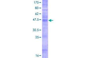 Image no. 1 for Transmembrane BAX Inhibitor Motif Containing 6 (TMBIM6) (AA 1-237) protein (GST tag) (ABIN1322908) (Bax Inhibitor 1 Protein (AA 1-237) (GST tag))