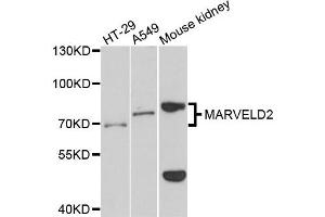 Western blot analysis of extracts of various cells, using MARVELD2 antibody. (Tricellulin antibody)