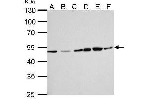 WB Image ERCC8 antibody [N2C2], Internal detects ERCC8 protein by Western blot analysis.