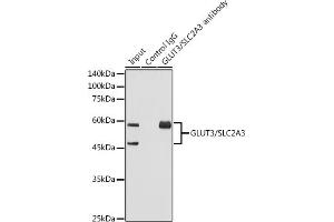 Immunoprecipitation analysis of 600 μg extracts of Mouse brain using 3 μg GLUT3/SLC2 antibody (ABIN7270415). (SLC2A3 antibody)