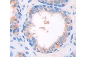 Used in DAB staining on fromalin fixed paraffin- embedded Kidney tissue (DOK3 antibody  (AA 45-310))