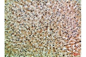 Immunohistochemical analysis of paraffin-embedded Human-liver, antibody was diluted at 1:100 (PPP1R13B antibody  (AA 630-680))
