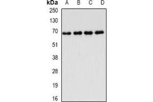 Western blot analysis of FIP1L1 expression in Jurkat (A), MCF7 (B), mouse thymus (C), rat lung (D) whole cell lysates. (FIP1L1 antibody)