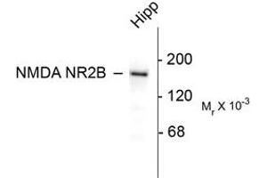 Image no. 1 for anti-Glutamate Receptor, Ionotropic, N-Methyl D-Aspartate 2B (GRIN2B) (C-Term) antibody (ABIN305791) (GRIN2B antibody  (C-Term))