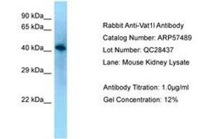 Image no. 1 for anti-Vesicle Amine Transport 1-Like (VAT1L) (AA 80-129) antibody (ABIN6749938) (VAT1L antibody  (AA 80-129))