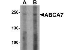 Western blot analysis of ABCA7 in 293 cell lysate with ABCA7 antibody at (A) 1 and (B) 2 ug/mL. (ABCA7 antibody  (N-Term))