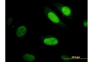 Immunofluorescence of monoclonal antibody to YAP1 on HeLa cell. (YAP1 antibody  (AA 53-161))