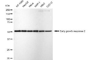 Western blotting analysis using Early growth response 2 antibody (ABIN7798422).
