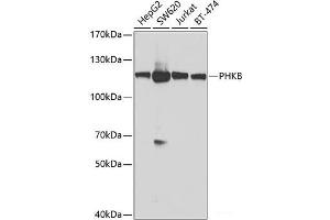 Western blot analysis of extracts of various cell lines using PHKB Polyclonal Antibody at dilution of 1:1000. (PHKB antibody)