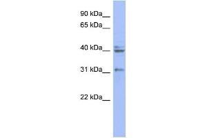 WB Suggested Anti-PABPN1 Antibody Titration: 0.