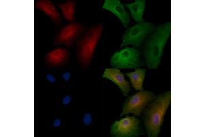 ABIN6258204 and ABIN6273883 staining  cells by IF/ICC. (GPR56 antibody  (C-Term))