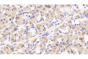 Detection of TLR5 in Human Stomach Tissue using Polyclonal Antibody to Toll Like Receptor 5 (TLR5) (TLR5 antibody  (AA 303-514))