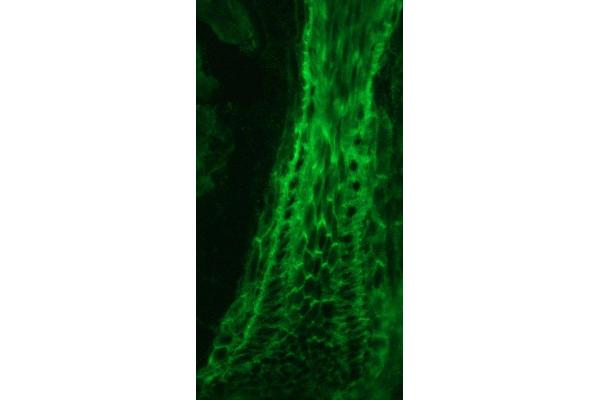 Plakophilin 3 antibody