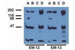 Western Blotting (WB) image for anti-Epidermal Growth Factor Receptor (EGFR) (pTyr1197) antibody (ABIN400879) (EGFR antibody  (pTyr1197))