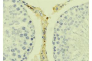 ABIN6278893 at 1/100 staining Mouse testis tissue by IHC-P. (IL17B antibody  (Internal Region))