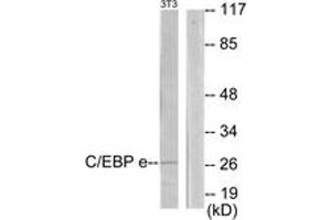 Western blot analysis of extracts from NIH-3T3 cells, using CEBPE Antibody. (CEBPE antibody  (AA 191-240))