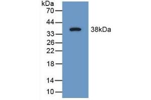 Detection of Recombinant SYN1, Mouse using Polyclonal Antibody to Synapsin I (SYN1) (SYN1 antibody  (AA 113-420))