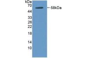 Detection of Recombinant DOK3, Human using Polyclonal Antibody to Docking Protein 3 (DOK3) (DOK3 antibody  (AA 128-385))
